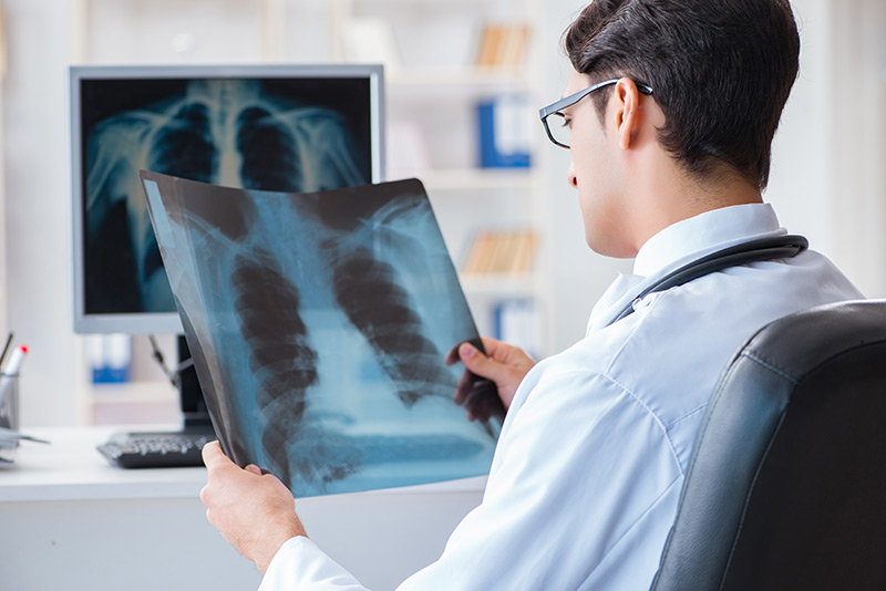 Shingles in Lung Disease
